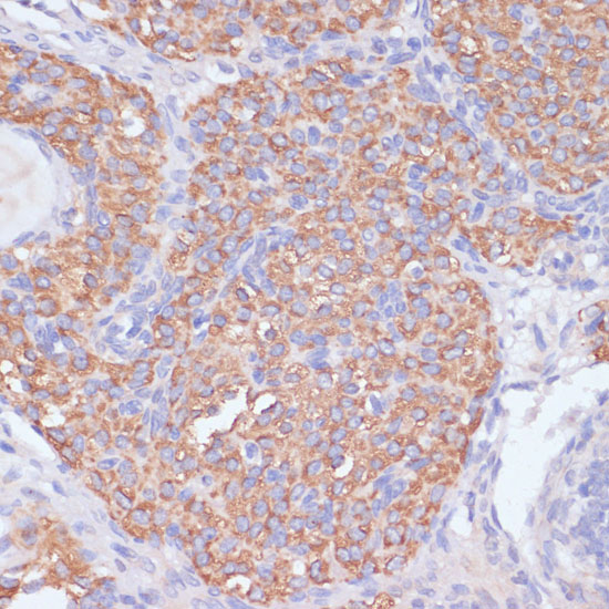 Anti-PI3 Kinase p85 beta Rabbit pAb