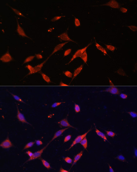 Anti-PI3 Kinase p85 beta Rabbit pAb