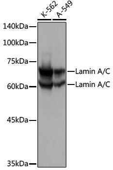 [KO Validated] Anti-Lamin A/C Rabbit pAb
