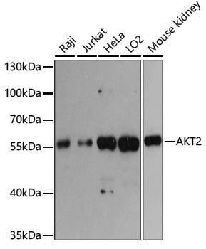 Anti-AKT2 Rabbit pAb
