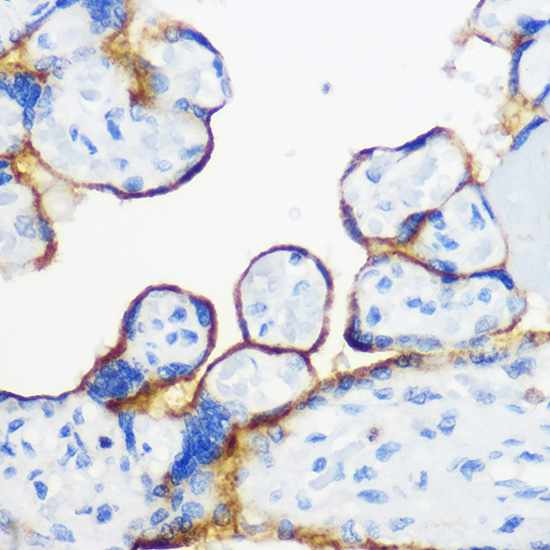 Anti-FYN Rabbit pAb