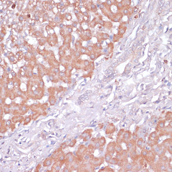 Anti-PI3 Kinase p85 beta Rabbit pAb