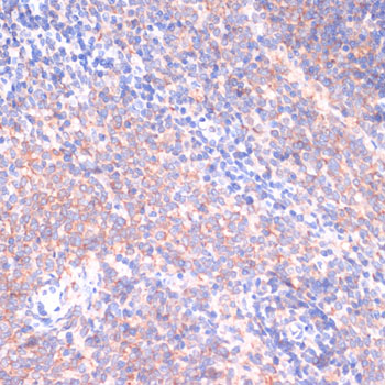Anti-PI3 Kinase p85 beta Rabbit pAb