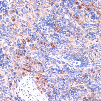 Anti-PI3 Kinase p85 beta Rabbit pAb