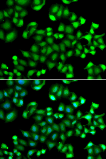 [KO Validated] Anti-MAPKAP Kinase 3 Rabbit pAb