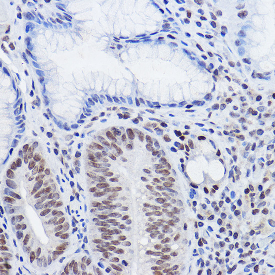 Anti-SIRT6 Rabbit pAb