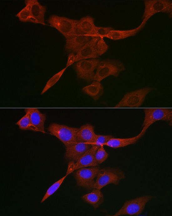 Anti-JAK1 Rabbit pAb