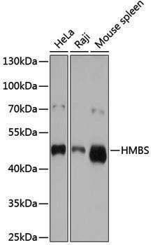 Anti-HMBS Rabbit pAb