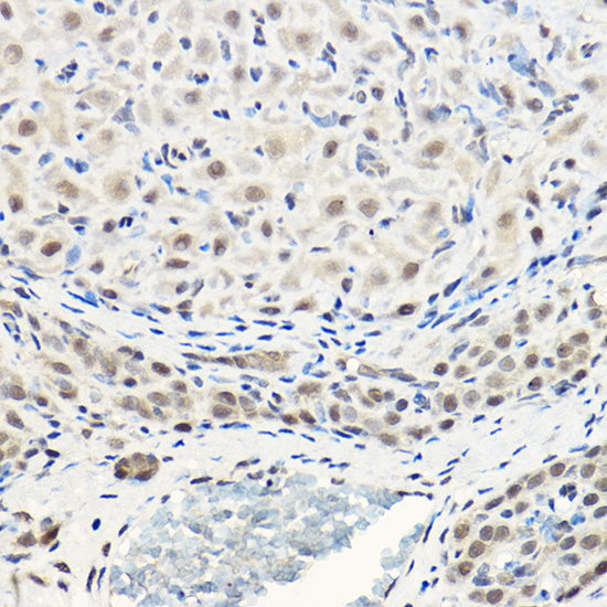 Anti-Pan-Akt Rabbit pAb