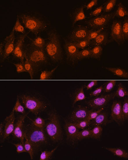 Anti-Pan-Akt Rabbit pAb