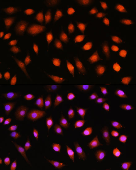 Anti-Pan-Akt Rabbit pAb