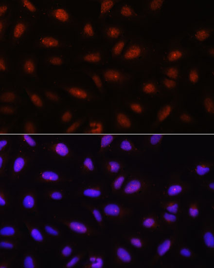 Anti-Pan-Akt Rabbit pAb