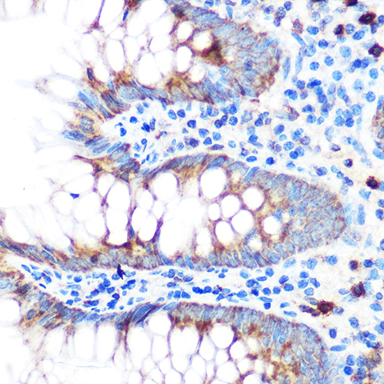 [KD Validated] Anti-Glutathione Peroxidase 4 Rabbit pAb