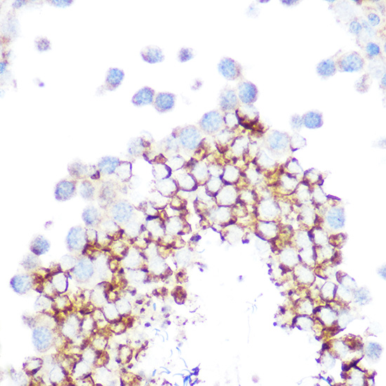 [KD Validated] Anti-Glutathione Peroxidase 4 Rabbit pAb