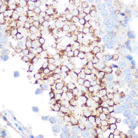 [KD Validated] Anti-Glutathione Peroxidase 4 Rabbit pAb