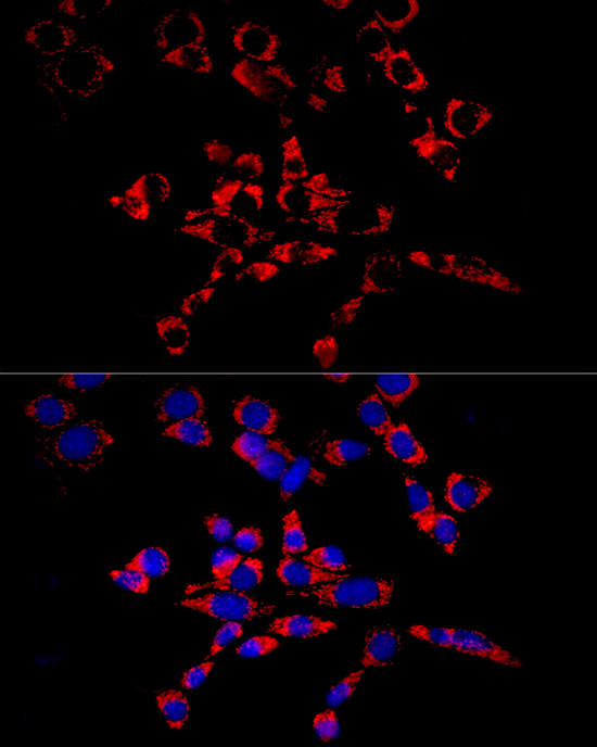 [KD Validated] Anti-Glutathione Peroxidase 4 Rabbit pAb