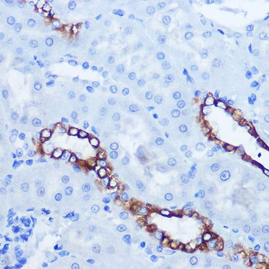 Anti-EPHA3/EPHA4/EPHA5 Rabbit pAb