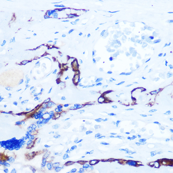 Anti-EPHA3/EPHA4/EPHA5 Rabbit pAb