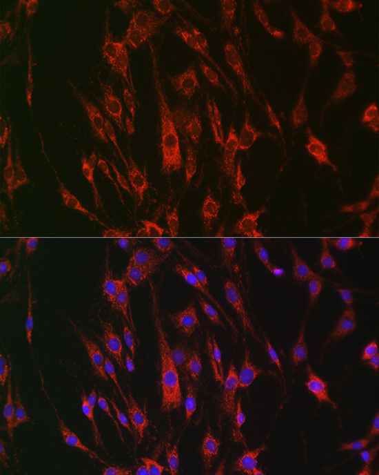 Anti-EPHA3/EPHA4/EPHA5 Rabbit pAb