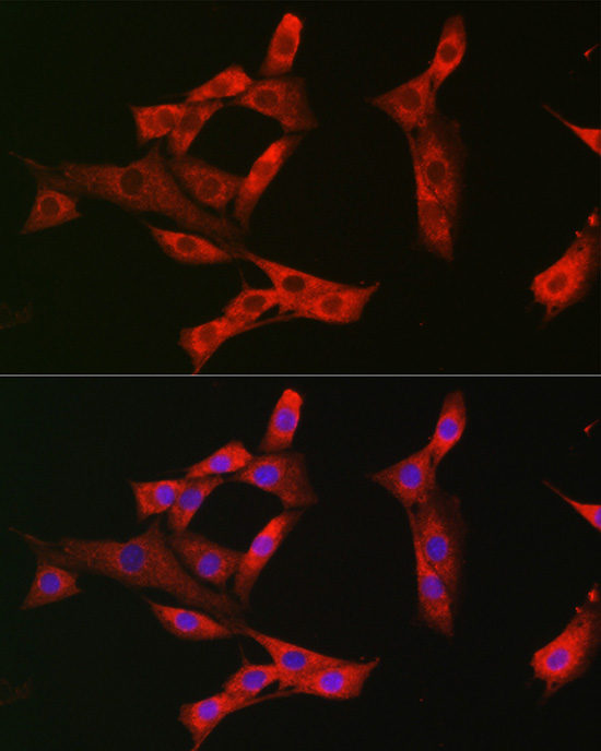 Anti-EPHA3/EPHA4/EPHA5 Rabbit pAb