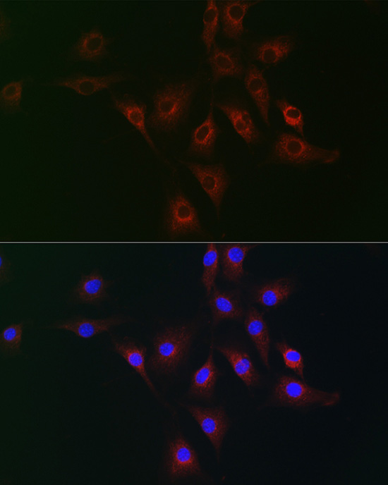 Anti-CD130 Rabbit pAb