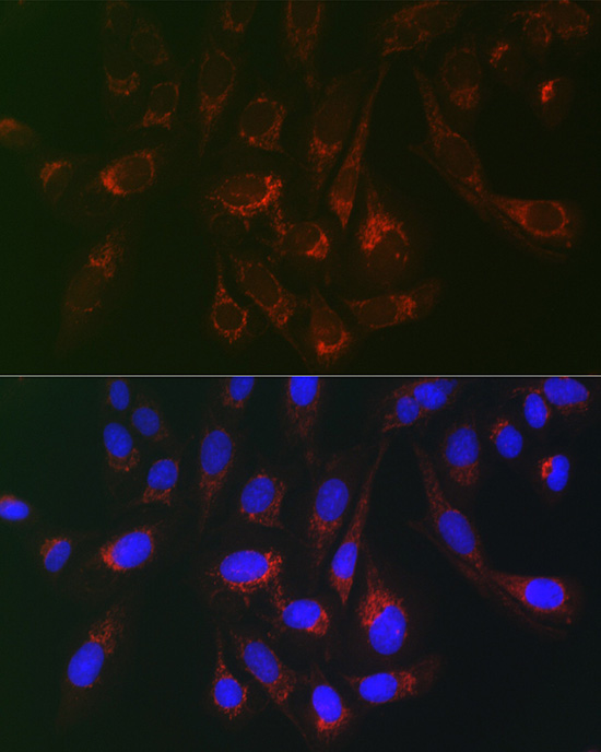 Anti-CD130 Rabbit pAb