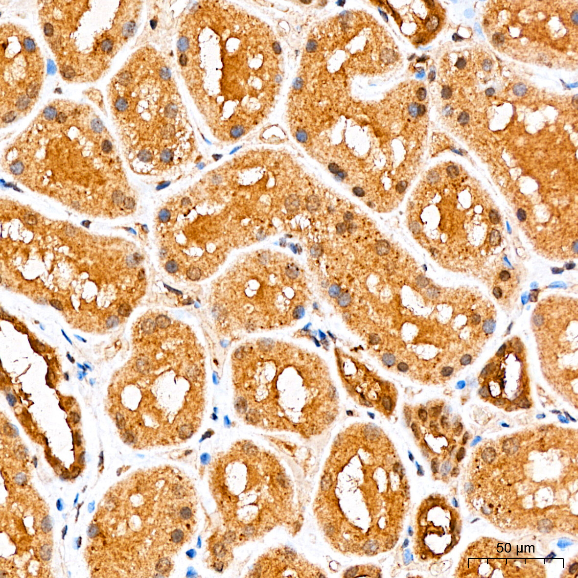 Anti-Smad2/3 Rabbit pAb