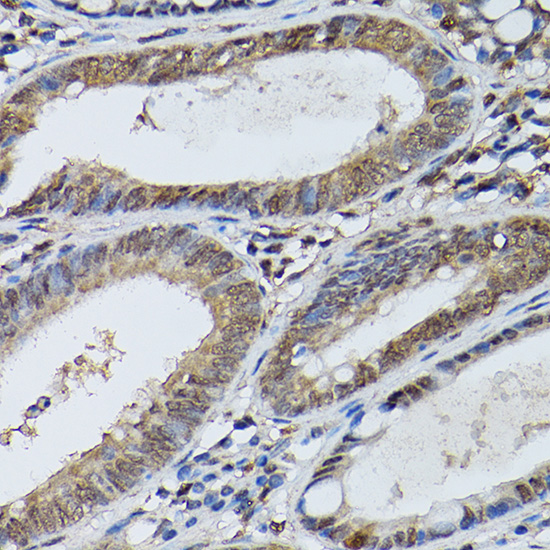 [KO Validated] Anti-STAT5b Rabbit pAb
