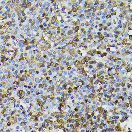 [KO Validated] Anti-STAT5b Rabbit pAb