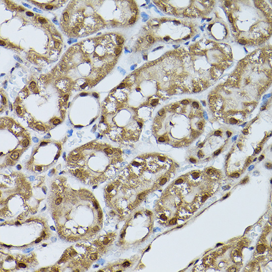 [KO Validated] Anti-STAT5b Rabbit pAb