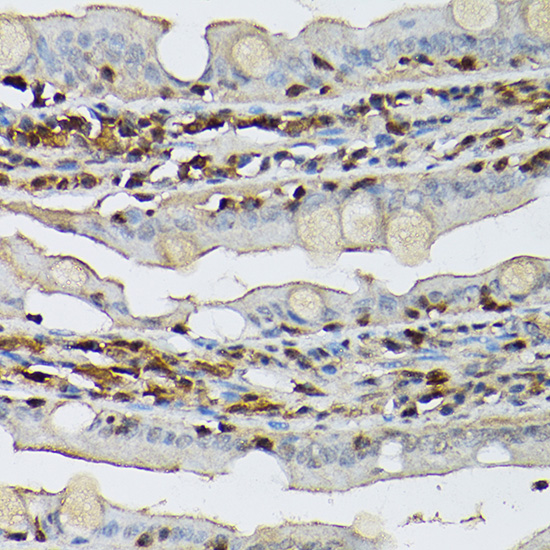[KO Validated] Anti-STAT5b Rabbit pAb