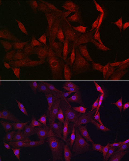 [KO Validated] Anti-STAT5b Rabbit pAb