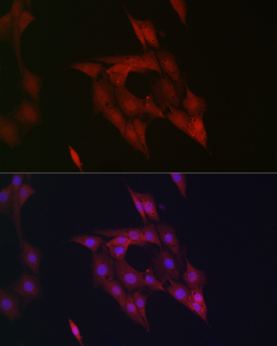 [KO Validated] Anti-STAT5b Rabbit pAb