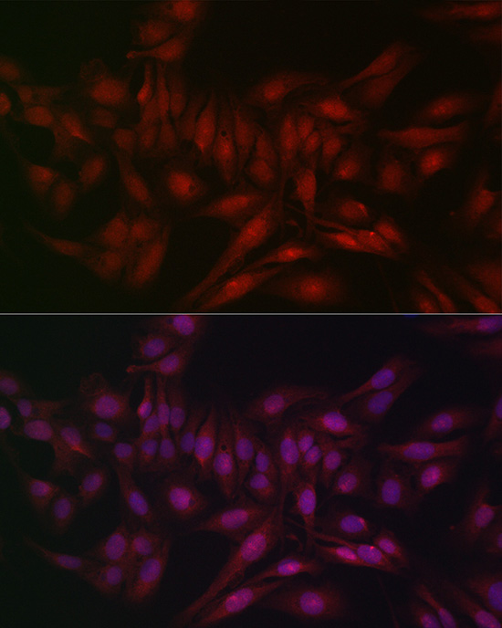 [KO Validated] Anti-STAT5b Rabbit pAb