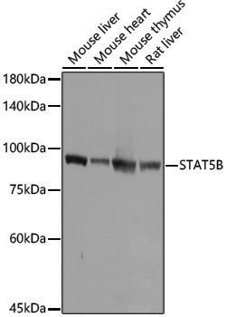 [KO Validated] Anti-STAT5b Rabbit pAb