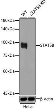 [KO Validated] Anti-STAT5b Rabbit pAb
