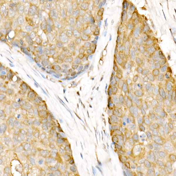 Anti-Hsp90 beta Rabbit pAb