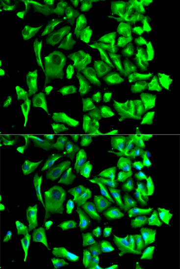 Anti-Hsp90 beta Rabbit pAb
