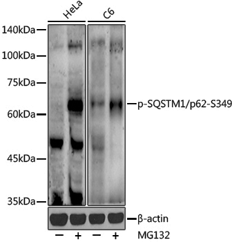 Anti-Phospho-SQSTM1/p62 (Ser349) Rabbit pAb