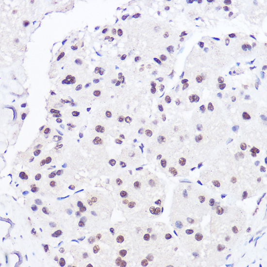 [KO Validated] Anti-BRG1 Rabbit pAb