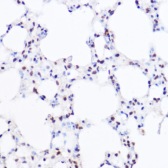 [KO Validated] Anti-BRG1 Rabbit pAb