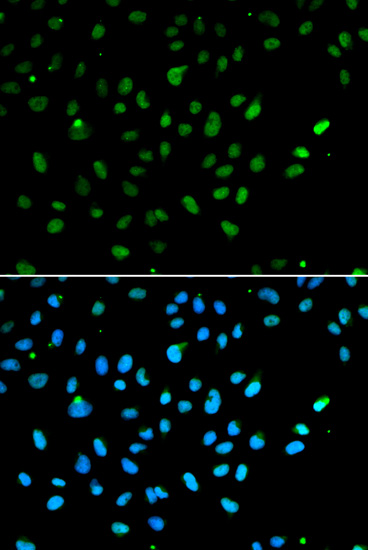 [KO Validated] Anti-BRG1 Rabbit pAb