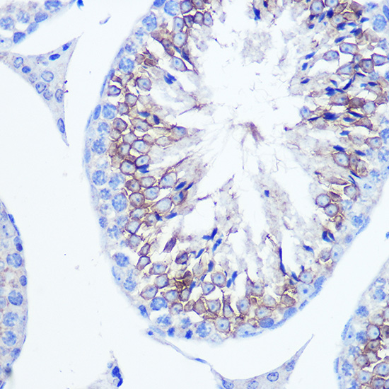 [KO Validated] Anti-Fascin Rabbit pAb