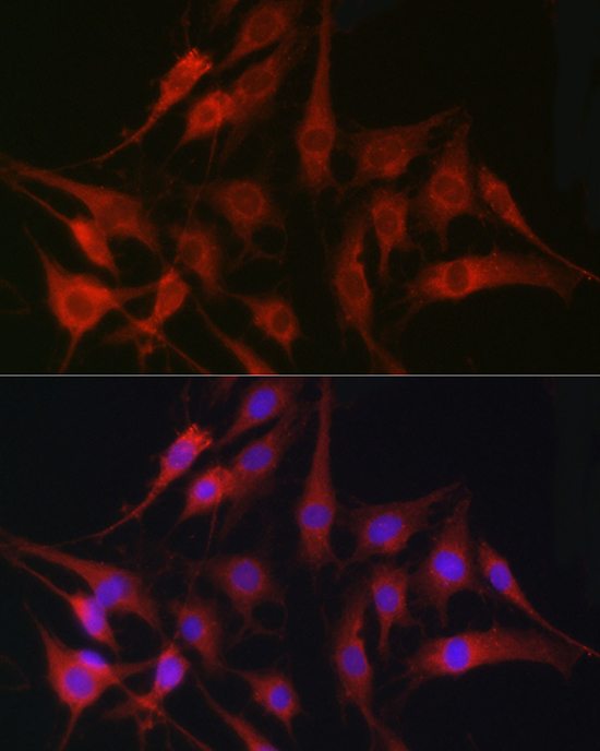[KO Validated] Anti-Fascin Rabbit pAb