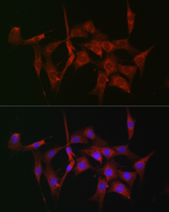 [KO Validated] Anti-Fascin Rabbit pAb