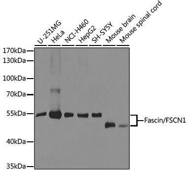 [KO Validated] Anti-Fascin Rabbit pAb
