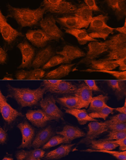 Anti-MALT1/MLT Rabbit pAb