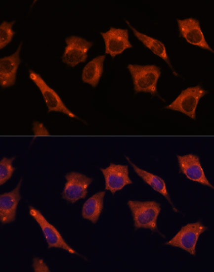 Anti-MALT1/MLT Rabbit pAb