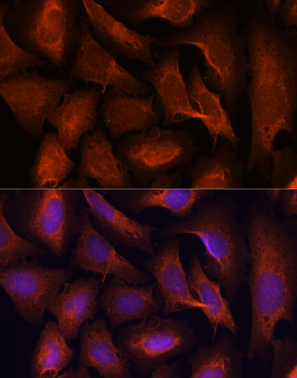 Anti-MALT1/MLT Rabbit pAb