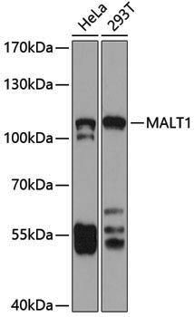 Anti-MALT1/MLT Rabbit pAb